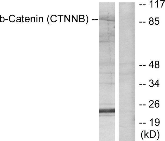 Anti-Catenin- antibody produced in rabbit