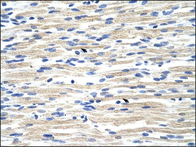 Anti-CBX6 (AB1) antibody produced in rabbit