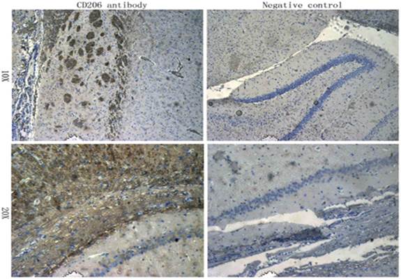 CD206 antibody,orb4941ͼƬ